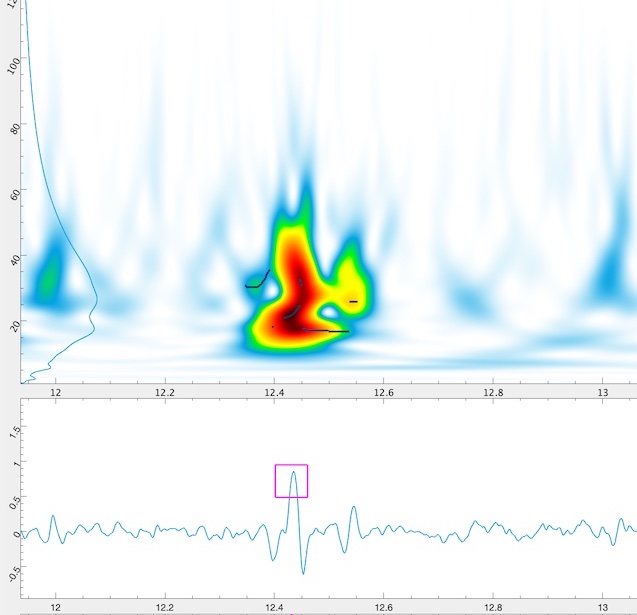 Wirelet signature of concentrated wear of internal wires